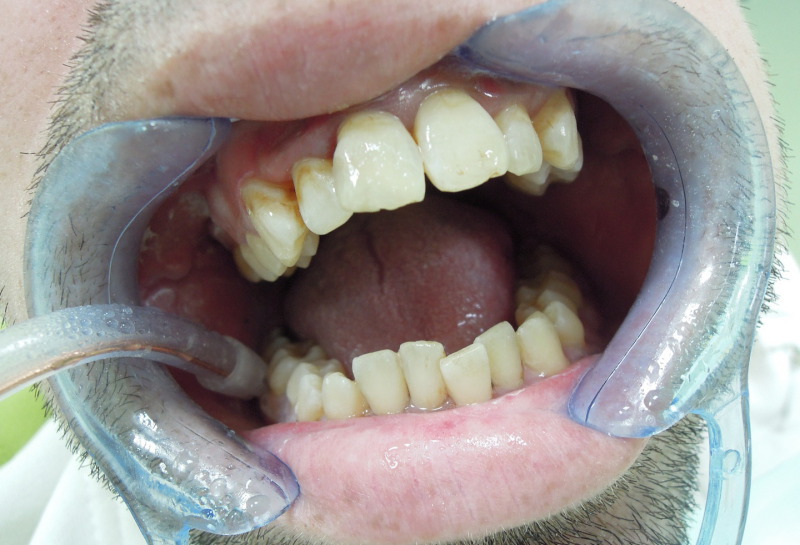 Tratamientos especiales